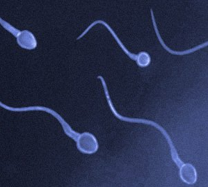 中度弱精的病因是什么？該怎么治療？